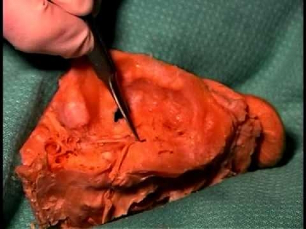 Cs.Kádár Péter - XXI. századi Diszkónika, 29. Végre boncolunk!