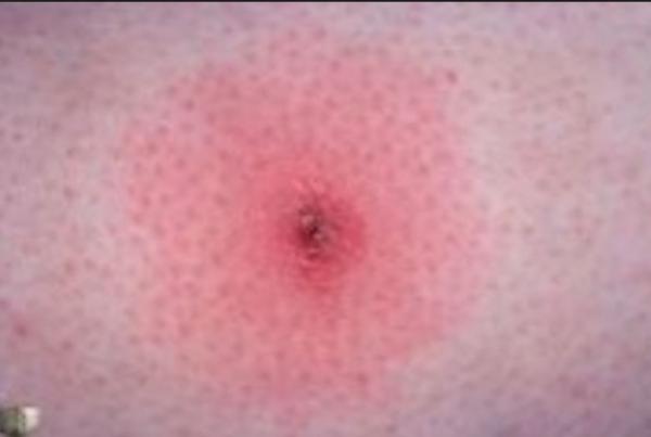 Cs.K&aacute;d&aacute;r P&eacute;ter - XXI. sz&aacute;zadi Diszk&oacute;nika, 117. Bolh&aacute;b&oacute;l mikrofont!